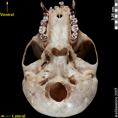 Boneviewer | eSkeletons